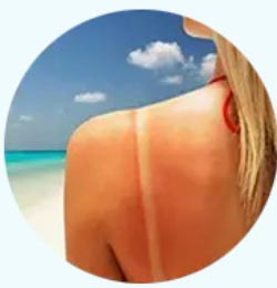 After-Sun Repair Liquid