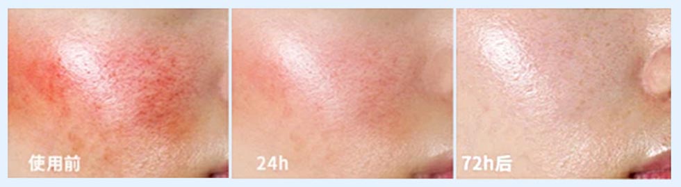 After-Sun Repair Liquid