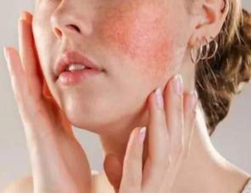 Whitening and Moisturizing Lotion